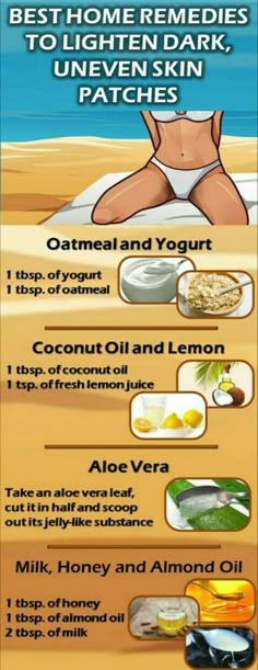 Benefits Of Coconut, Skin Patches, Benefits Of Coconut Oil, Beauty Remedies, Skin Remedies