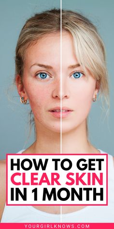 Generated Description with relevant hashtags. How To Get Healthier Skin, How To Get The Clearest Skin, Tips To Have Clear Skin, How To Keep Your Skin Clear, How To Have Clear Face, Things For Clear Skin, Clear Complexion Tips, How To Make Your Face Clear, How To Have Clear Skin Tips