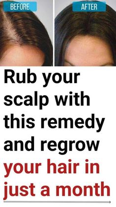 Rub your scalp with this remedy and regrow your hair in just a month Hair Growth Formula, Hair Supplements, Stimulate Hair Follicles, Boost Hair Growth