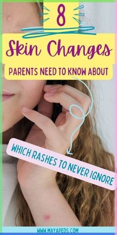 Rashes in Babies and Kids: Skin Rashes Paren Skin Rash On Face, Rash On Face, Home Remedies For Skin, Skin Rashes, Pimples Remedies, Natural Hair Mask, Face Care Routine, Dry Skin Patches