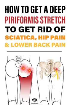 how to get a deep phromis stretch to get rid of sciatica, hip pain and lower back pain