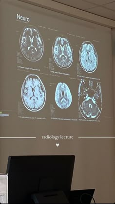 a man standing in front of a projector screen with mri images projected on it