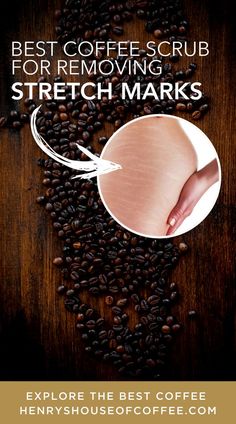 Stretch marks develop on your skin if you undergo rapid weight gain, weight loss, or especially during a pregnancy. One of the most commonly hailed home remedies for reducing the appearance of stretch marks involves the use of coffee grounds. Make this recipe to get rid of stretch marks w #coffee to help you improve the appearance of your stretch marks in only a few weeks! | Henry's House of Coffee Blog | Skin Care Tips |#stretchmarks #coffeescrub #skincaretips #coffeerecipe #naturalremedies Lip Scrub Recipe, Lotion For Oily Skin, Tips For Oily Skin, Eye Skin Care, Coffee Blog