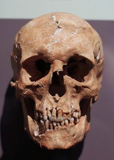 a human skull is displayed on a table