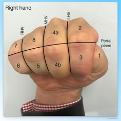 a man's hand with four lines drawn on it to show the width of his fist