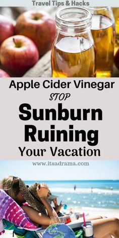 Vinegar For Sunburn, Sunburn Blisters, Home Remedies For Sunburn, How To Make Home, Sunburn Remedies, Sunburn Relief, Home Remedy For Cough, Skin Natural Remedies, Cold Sores Remedies