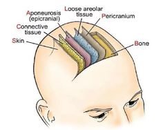 the head and neck are labeled with different types of hair, including an area that has been