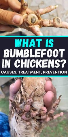 what is bumblefoot in chickens? cause, treatment, and prevention for them