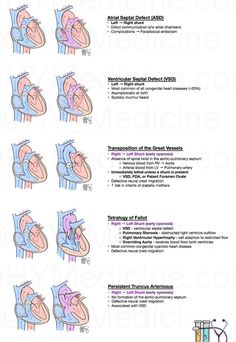 the diagram shows different stages of heart surgery