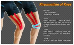 Kinesiology taping instructions for rheumatism of the knee #ktape #ares #knee #rheumatism Message Therapy, Bad Knee Workout, Sports Tape, Athletic Trainer