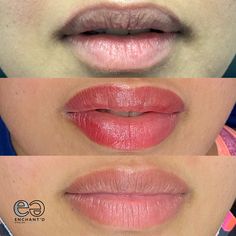 Permanent Lip Color Tattoo Before And After, Lip Blushing Tattoo Before And After, Lip Blush Tattoo, Lipstick Tattoo, Blush Tattoo, Beauty Loft, Lips Fillers