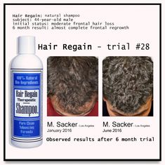 HAIR REGAIN REGROWTH SHAMPOO -real eBay reviews from our hair growth buyers-                          Hair Regain Shampoo is great!                               Buyer: 22cake (32)                      Feb-11-21   271751702751                 Great product. Thank you for selling it!                          Buyer: sumannet (577)                 Feb-10-21   271408307633                  Seeing growth! Will order more                                  Buyer: sbhaf2 (85)                       Feb-04 Hair Regrowth Remedies, Thicker Stronger Hair, Hair Regrowth Shampoo, Natural Hair Regrowth, Shampoo Ingredients, All Types Of Hair, Regrow Hair, Hair Control, Types Of Hair