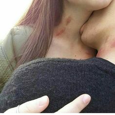 a close up of a person holding a cell phone near her ear and nose with blood on it