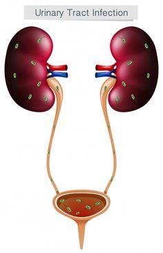 Human Body Science Projects, Lower Abdominal Pain, Human Body Science, Squamous Cell, Urinary Health, Pelvic Pain