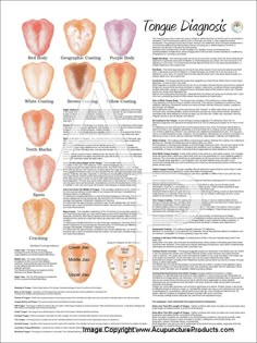 Chinese Medicine Tongue Diagnosis Poster Traditional Chinese Medicine, 5 Pounds