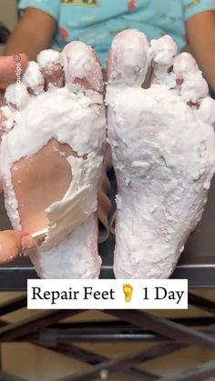 Cracked Hands Remedy, Soft Feet Remedy, Cracked Heels Diy, Cracked Feet Remedies, Moisturized Hands, Cracked Heel Remedies, Melted Candle, Smooth Hands, Dry Cracked Heels