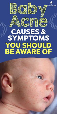 a baby with acne on it's head and the words, body acne cause & symptoms you should be aware of