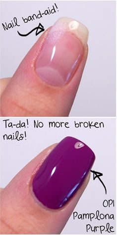 Popular Diy Crafts, Broken Toenail, Fix Broken Nail, Repair Broken Nail, Fingernail Health, Broken Finger, Popular Diy, Hard Nails