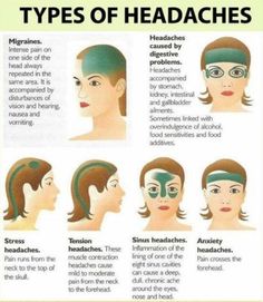 Types of Headaches Different Types Of Headaches, Bolesti Chrbta, Headache Types, Reiki Meditation, Migraine Relief, Headache Relief, Migraine Headaches, Medical Knowledge, Health Info