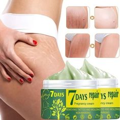 Stretch Mark Removal Cream, Marks Cream, Stretch Mark Cream, Stretch Mark Removal, Acne Scar, Body Creams, Stretch Mark, Perfect Skin Care Routine