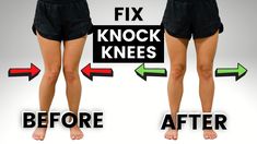 the before and after pictures show how to fix your knees in less than 10 minutes