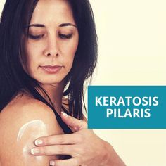 Keratosis Pilaris Remedy, Skin Education, Medical Esthetics, Master Esthetician, Skin Studio, Red Rash, Clean Beauty Makeup, Professional Skincare, Green Clean