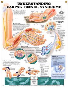 Carpal Tunnel Syndrome Carpal Tunnel Exercises, Carpal Tunnel Relief, Hand Therapy, Healthy Lifestyle Changes, Carpal Tunnel, Medical Knowledge, Bench Press, Health Info, Occupational Therapy