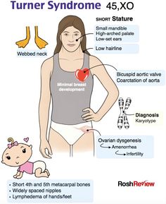 a woman with her stomach exposed and labeled in the diagram