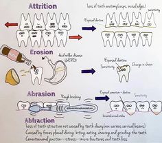 Dental Hygiene Hacks, Dental Histology Notes, Teaching Dental Assisting, Orthodontic Assistant Study Guides, Dental Hygienist Operatory Decor, Dental Nurse Revision, Dental Hygiene School Study Guides, Dental Assistant Study Notes