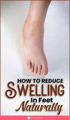 Swollen Legs Remedies, Daily Health Tips, Detox Your Body