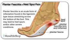 Foot Pain, Health Info, Natural Treatments, Massage Therapy, Acupuncture