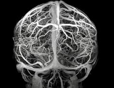 an x - ray view of the human brain showing its major branches and blood vessels