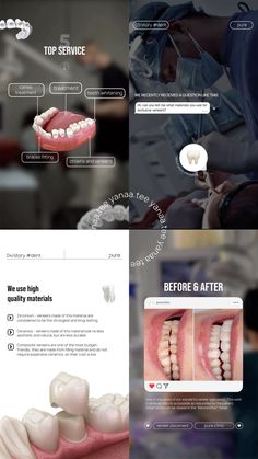 Dentist Content Ideas, Dentist Instagram Posts, Dental Post Ideas, Dentist Website Design, Dental Marketing Social Media, Dental Instagram, Dental Content, Dental Post