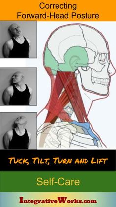 Cervicogenic Headache, Therapy Notes, Neck Ache, Fascia Lata, Eye Pain