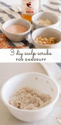 Get rid of unwanted dandruff with these 4 simple DIY scalp scrub recipesPluswhat essential oils to add to help with hair growth. Scalp Scrub For Dandruff, Diy Scalp Scrub, Diy Hair Scrub, What Causes Dandruff, Dry Scalp Remedy, Hair Mask For Dandruff, Oils For Dandruff, Clean Scalp