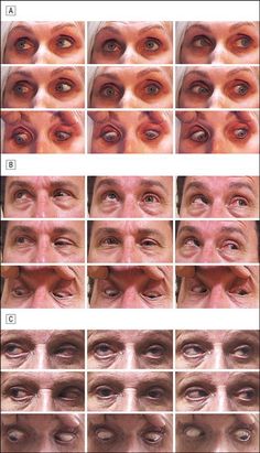 an image of different types of eyes