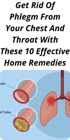 Get Rid Of Phlegm From Your Chest And Throat With These 10 Effective Home Remedies Getting Rid Of Mucus, Chest Congestion Remedies, Congestion Remedies, Getting Rid Of Phlegm, Best Cough Remedy, Chest Congestion, Home Remedy For Cough