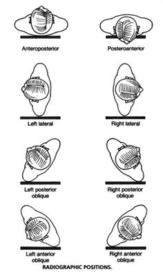 the diagram shows different types of mitts and their functions in each region of the body