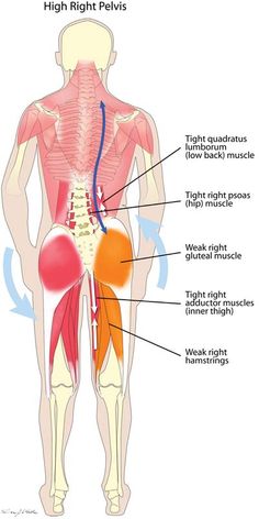 Misaligned Pelvis, Punkty Spustowe, Muscle Imbalance, Spine Health, Muscle Anatomy, Simple Health, Hip Muscles, Back Pain Exercises, Body Anatomy