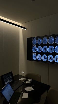 a laptop computer sitting on top of a table in front of a large screen with mri images