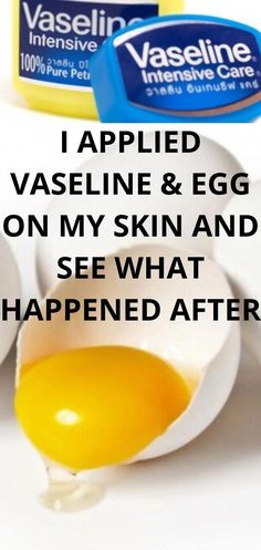 Use Vaseline and Egg and See How Your Face Will Change in 1 Night. It removed Wrinkles, Dark Spots, Pigmentation and get rid of uneven skin tone, hyperpigmen... Egg Yolk Face Mask, Face Wrinkles Anti Aging, Vaseline Uses For Face, Vaseline For Face, Egg Face Mask, Egg White Face Mask, Healing Ideas, Egg Mask