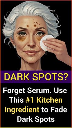 Think wrinkles are the most visible indicator of aging? Think again. Dark spots might be the indicator that your skin is aging. Dr. Sarah Jensen, dual board-certified dermatologist with 20 years of experience, challenges this prevalent belief and pinpoints some causes of dark spots. Receive Dr. Jensen’s step-by-step guide that might help to improve dark spots. #skin #sunspots #lighterskin #darkspots #skincare #agespots #healthyskin Bliss Skin, Darkspots Skincare, Diy Facial Hair Removal, Turmeric Mask, Retinol Alternative, Dark Spots On Face, Tone Skin, Bleaching Cream