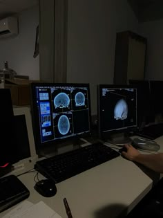 a man sitting at a desk in front of three monitors with mri images on them