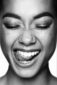 a black and white photo of a woman's face with freckled hair