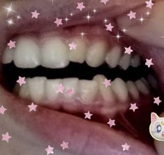 an open mouth with white teeth and pink stars on the wall behind it, as well as a sticker that says hello kitty