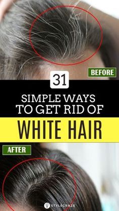 Get Rid Of White Hair, Remedy For White Hair, Grey Hair Remedies, Ayurvedic Hair Oil, Hair Pack, Lost Hair, Hair Remedies, Beauty Advice, Hair Problems