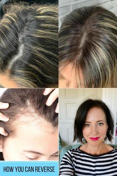 hair strands falling out Strand Of Hair, Hair Strands, Hair Regrowth, Hair Strand, Your Head, Homemade Recipes, Health, Hair