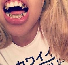 vampire grillz, single tooth grill, silver tooth, silver teeth, silver mouth grillz, CZ diamond Vampire Grillz, Gold Fangs, Girl Grillz, Fang Grillz, Grillz Teeth, Gold Grill, Studera Motivation, Gold Grillz, Grills Teeth