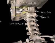 Nerves Anatomy, Cervicogenic Headache, Nerve Anatomy, How To Stop Snoring, Shoulder Pain Relief, Spine Health, Nerve Pain Relief, Body Joints