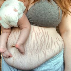 a woman holding a baby in her arms with white spots on it's stomach